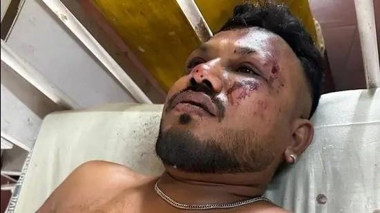 Một phần xác máy bay còn lại sau vụ nổ (ảnh: EPA)