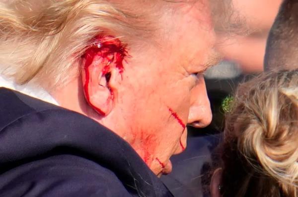 Trump kể về trải nghiệm siêu thực khi bị bắn, nói rằng ông lẽ ra đã chết