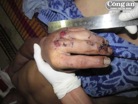 Giải mã tử thi (2)