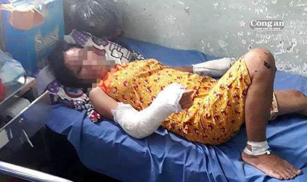 Chồng vũ phu đánh vợ mang thai dã man