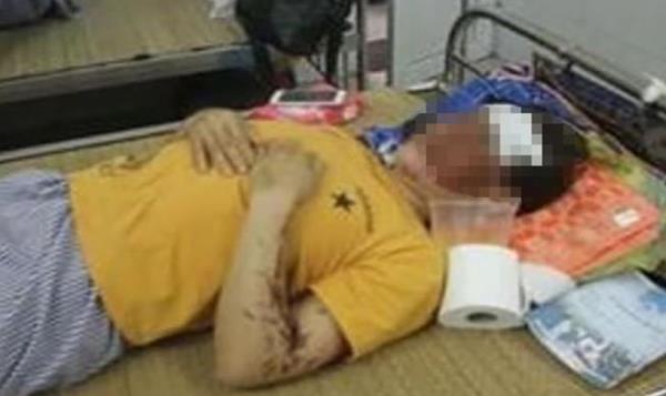 Người phụ nữ ghen ngược, tạt acid vào vợ nhân tình